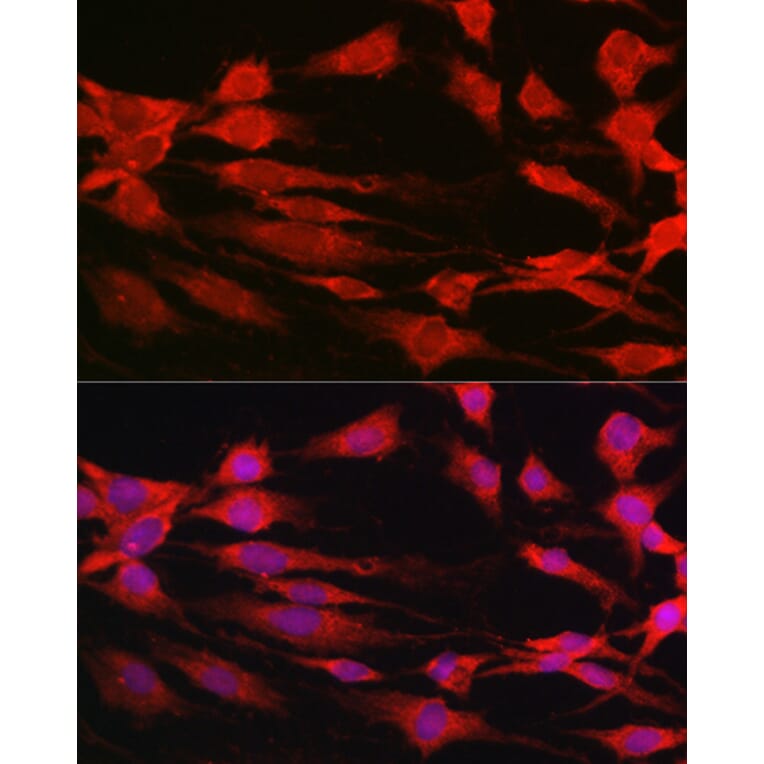 Immunofluorescence - Anti-S6K1 Antibody (A13944) - Antibodies.com