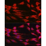 Immunofluorescence - Anti-S6K1 Antibody (A13944) - Antibodies.com