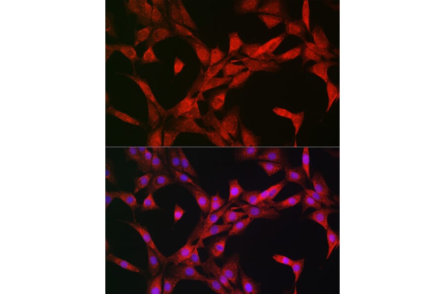 Immunofluorescence - Anti-S6K1 Antibody (A13944) - Antibodies.com