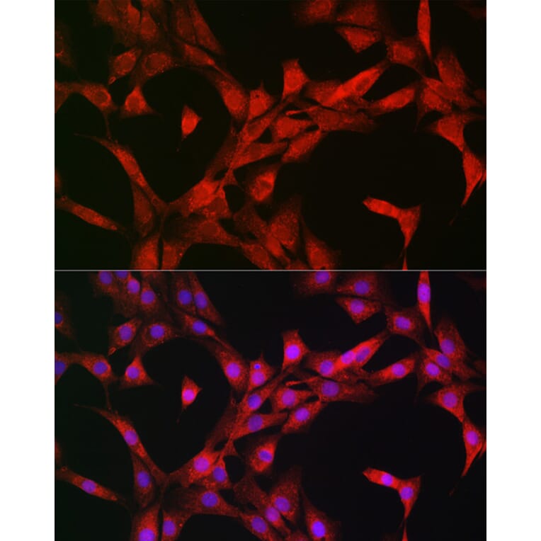 Immunofluorescence - Anti-S6K1 Antibody (A13944) - Antibodies.com