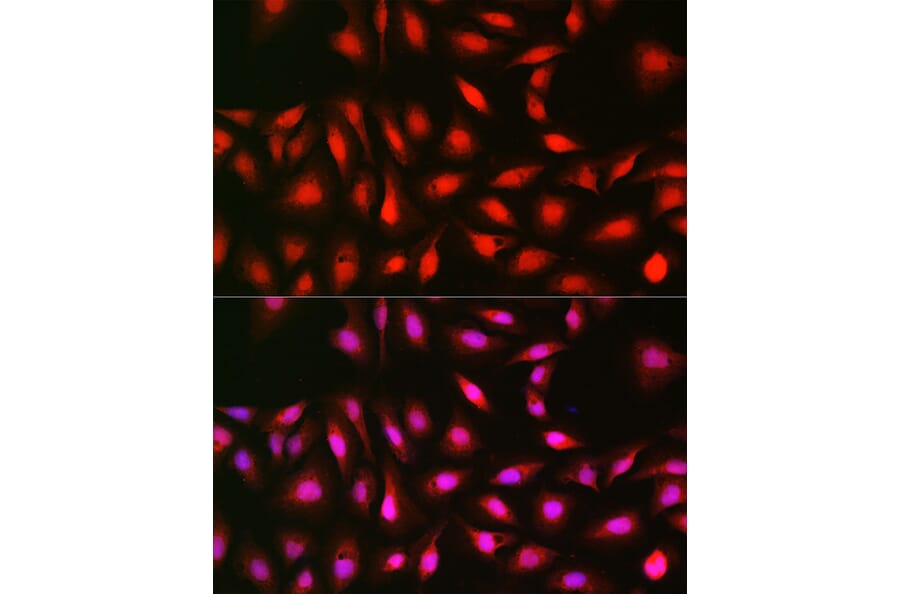 Immunofluorescence - Anti-S6K1 Antibody (A13944) - Antibodies.com