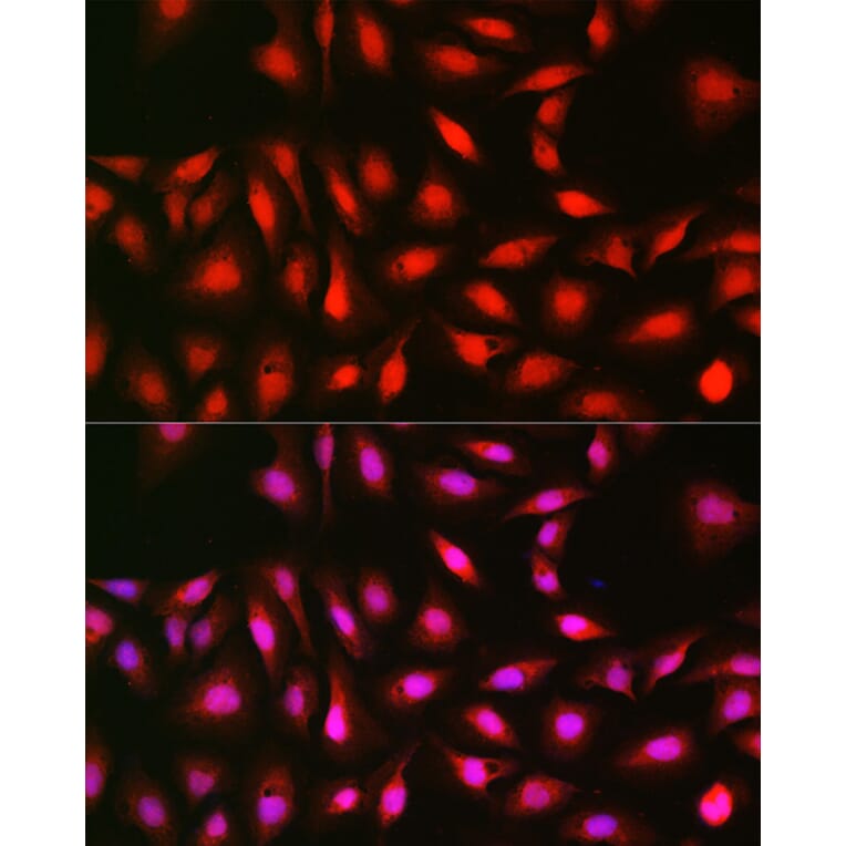 Immunofluorescence - Anti-S6K1 Antibody (A13944) - Antibodies.com