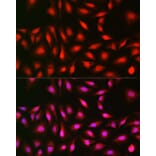 Immunofluorescence - Anti-S6K1 Antibody (A13944) - Antibodies.com