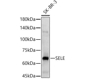 Western Blot - Anti-CD62E Antibody (A13945) - Antibodies.com