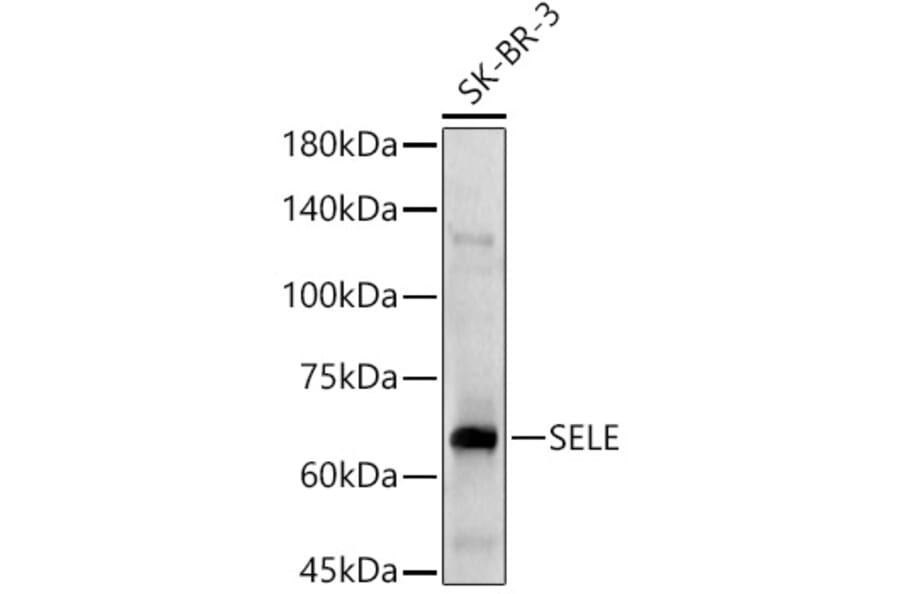 Western Blot - Anti-CD62E Antibody (A13945) - Antibodies.com