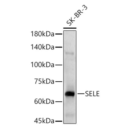 Western Blot - Anti-CD62E Antibody (A13945) - Antibodies.com