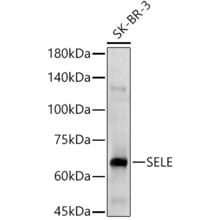 Western Blot - Anti-CD62E Antibody (A13945) - Antibodies.com