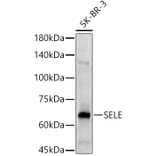 Western Blot - Anti-CD62E Antibody (A13945) - Antibodies.com