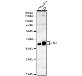 Western Blot - Anti-TATA binding protein TBP Antibody (A13946) - Antibodies.com