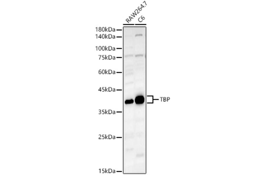 Western Blot - Anti-TATA binding protein TBP Antibody (A13946) - Antibodies.com
