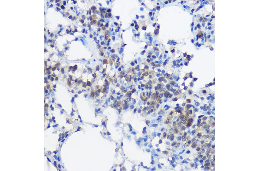 Immunohistochemistry - Anti-UBE2I/UBC9 Antibody (A13947) - Antibodies.com