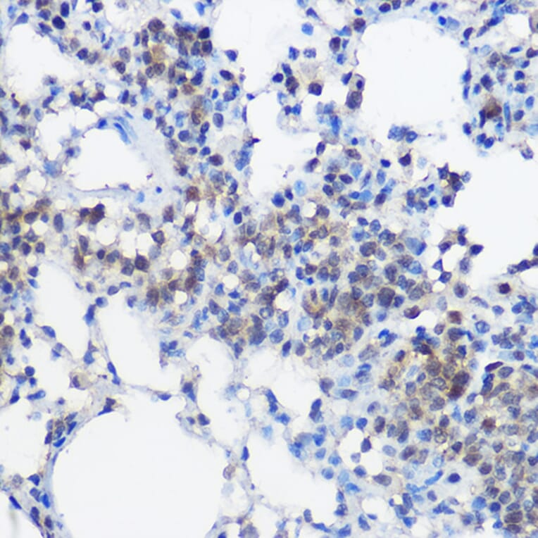 Immunohistochemistry - Anti-UBE2I/UBC9 Antibody (A13947) - Antibodies.com