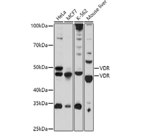 Western Blot - Anti-Vitamin D Receptor Antibody (A13948) - Antibodies.com