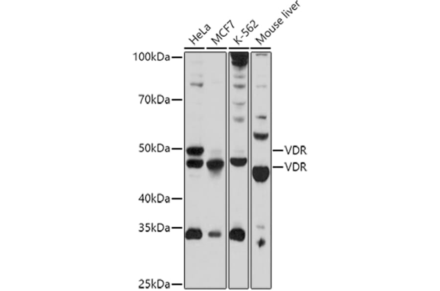 Western Blot - Anti-Vitamin D Receptor Antibody (A13948) - Antibodies.com