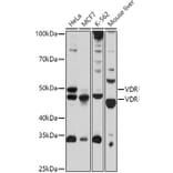 Western Blot - Anti-Vitamin D Receptor Antibody (A13948) - Antibodies.com