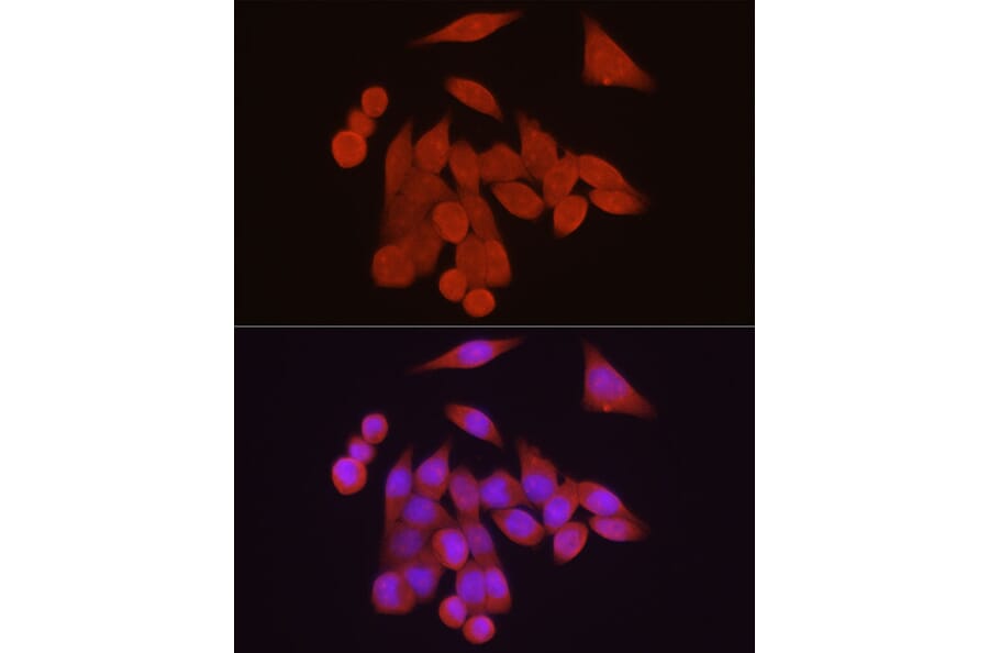 Immunofluorescence - Anti-Vitamin D Receptor Antibody (A13948) - Antibodies.com