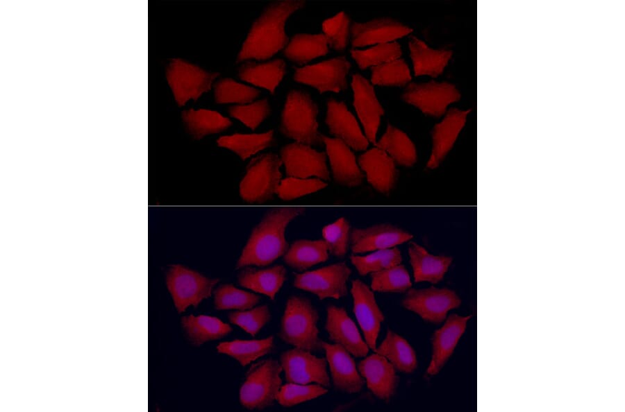 Immunofluorescence - Anti-Vitamin D Receptor Antibody (A13948) - Antibodies.com