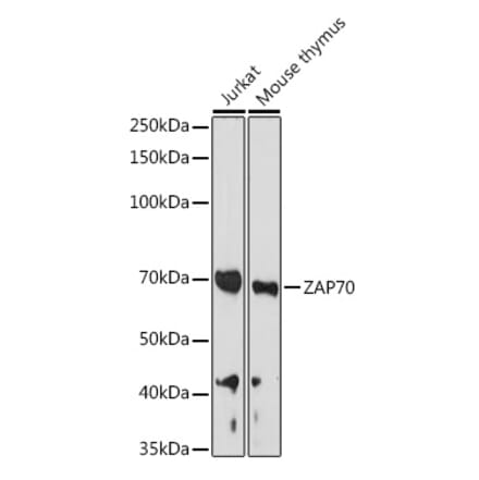 Western Blot - Anti-ZAP70 Antibody (A13949) - Antibodies.com