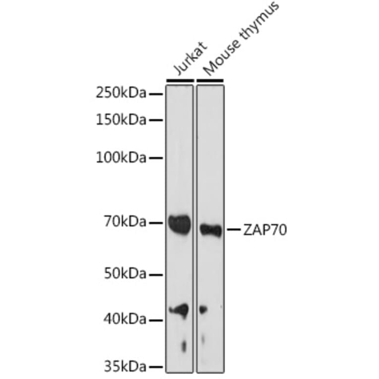 Western Blot - Anti-ZAP70 Antibody (A13949) - Antibodies.com