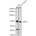 Western Blot - Anti-ZAP70 Antibody (A13949) - Antibodies.com