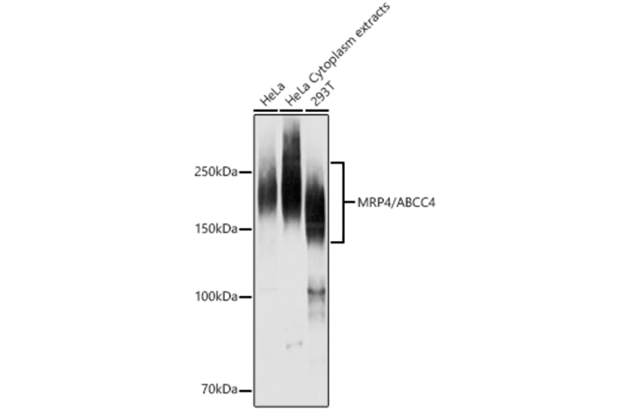 Western Blot - Anti-MRP4 Antibody (A13951) - Antibodies.com