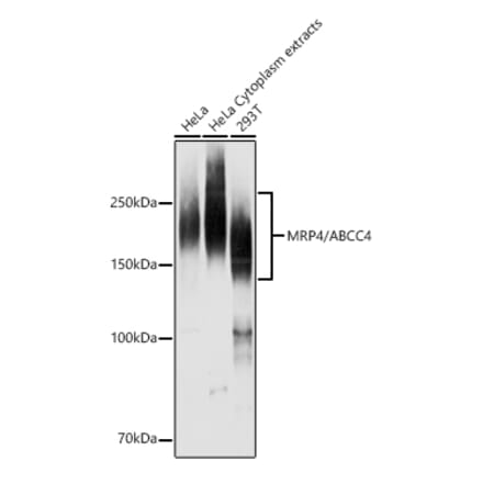 Western Blot - Anti-MRP4 Antibody (A13951) - Antibodies.com