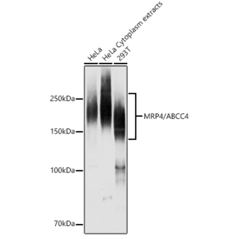 Western Blot - Anti-MRP4 Antibody (A13951) - Antibodies.com