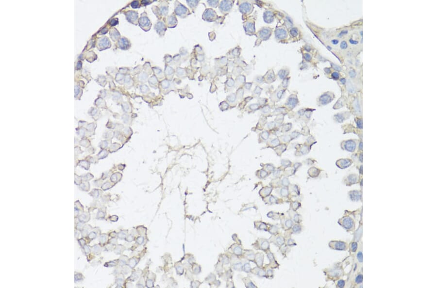 Immunohistochemistry - Anti-MRP4 Antibody (A13951) - Antibodies.com
