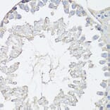 Immunohistochemistry - Anti-MRP4 Antibody (A13951) - Antibodies.com