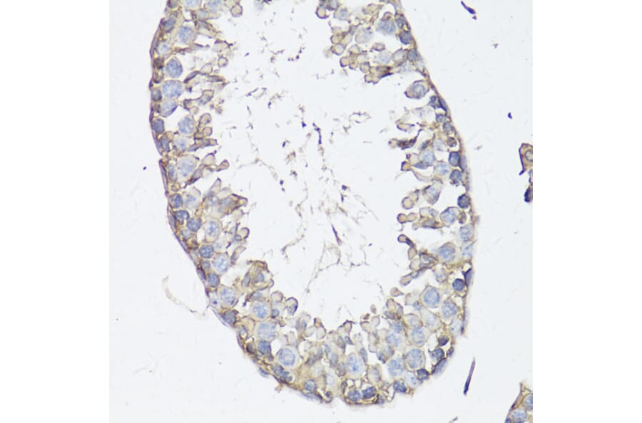 Immunohistochemistry - Anti-MRP4 Antibody (A13951) - Antibodies.com