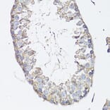 Immunohistochemistry - Anti-MRP4 Antibody (A13951) - Antibodies.com