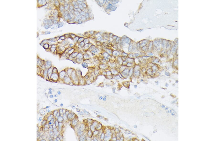 Immunohistochemistry - Anti-MRP4 Antibody (A13951) - Antibodies.com