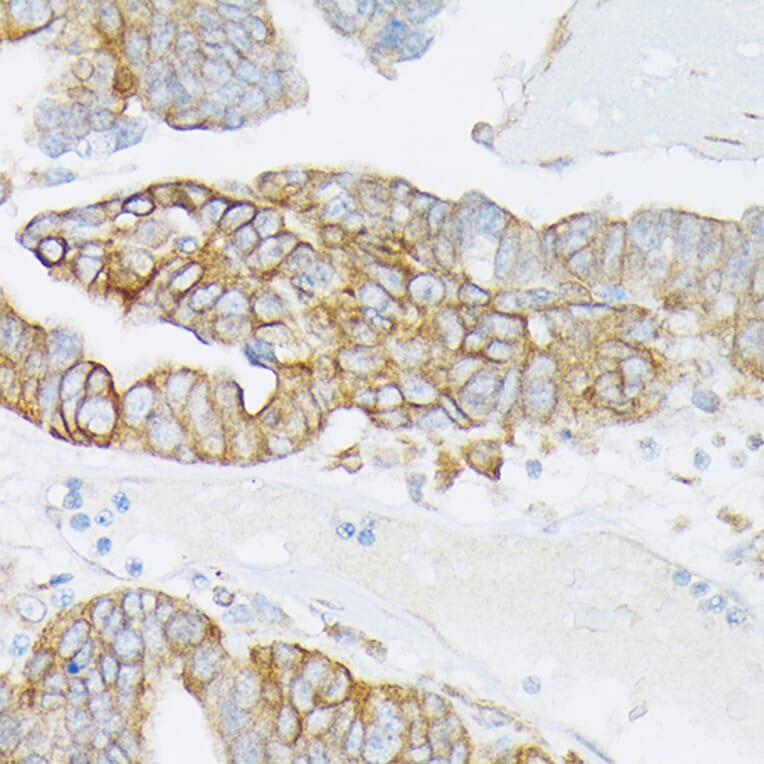 Immunohistochemistry - Anti-MRP4 Antibody (A13951) - Antibodies.com