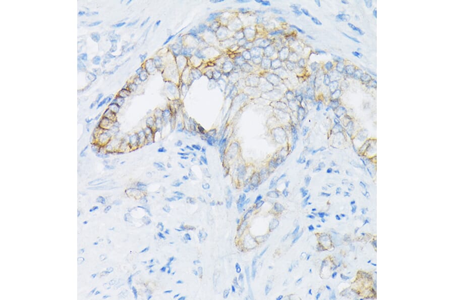Immunohistochemistry - Anti-MRP4 Antibody (A13951) - Antibodies.com