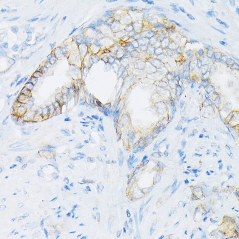 Immunohistochemistry - Anti-MRP4 Antibody (A13951) - Antibodies.com