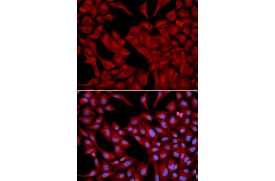 Immunofluorescence - Anti-p50 dynamitin Antibody (A13953) - Antibodies.com