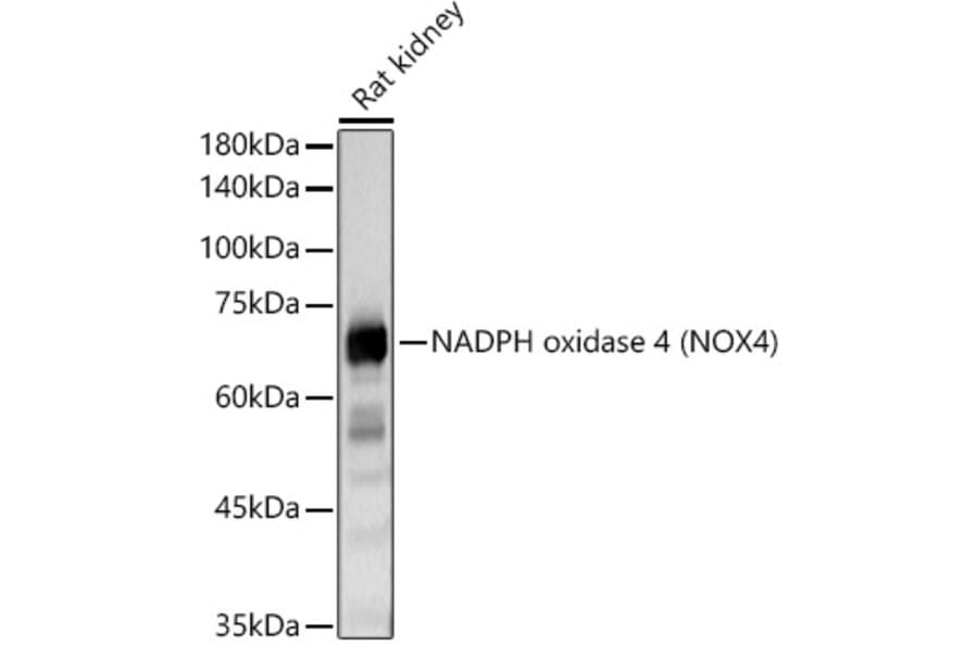 Western Blot - Anti-NADPH oxidase 4 Antibody (A13954) - Antibodies.com