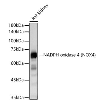 Western Blot - Anti-NADPH oxidase 4 Antibody (A13954) - Antibodies.com