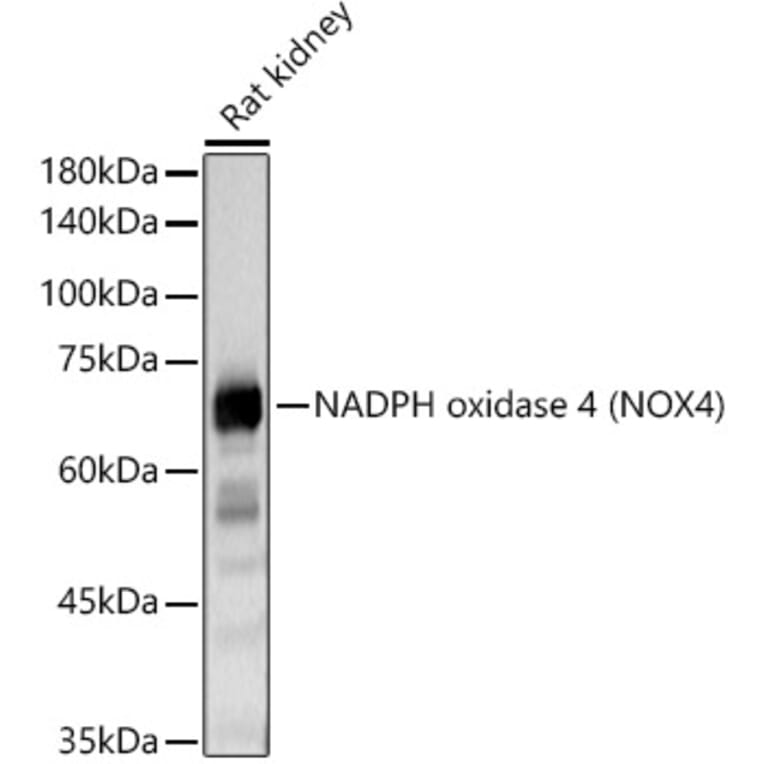 Western Blot - Anti-NADPH oxidase 4 Antibody (A13954) - Antibodies.com