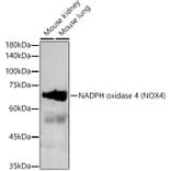 Western Blot - Anti-NADPH oxidase 4 Antibody (A13954) - Antibodies.com