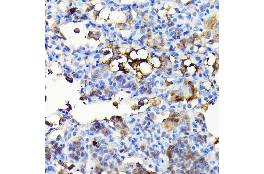 Immunohistochemistry - Anti-NADPH oxidase 4 Antibody (A13954) - Antibodies.com