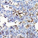 Immunohistochemistry - Anti-NADPH oxidase 4 Antibody (A13954) - Antibodies.com