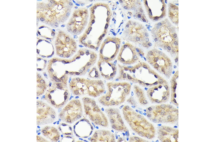 Immunohistochemistry - Anti-NADPH oxidase 4 Antibody (A13954) - Antibodies.com