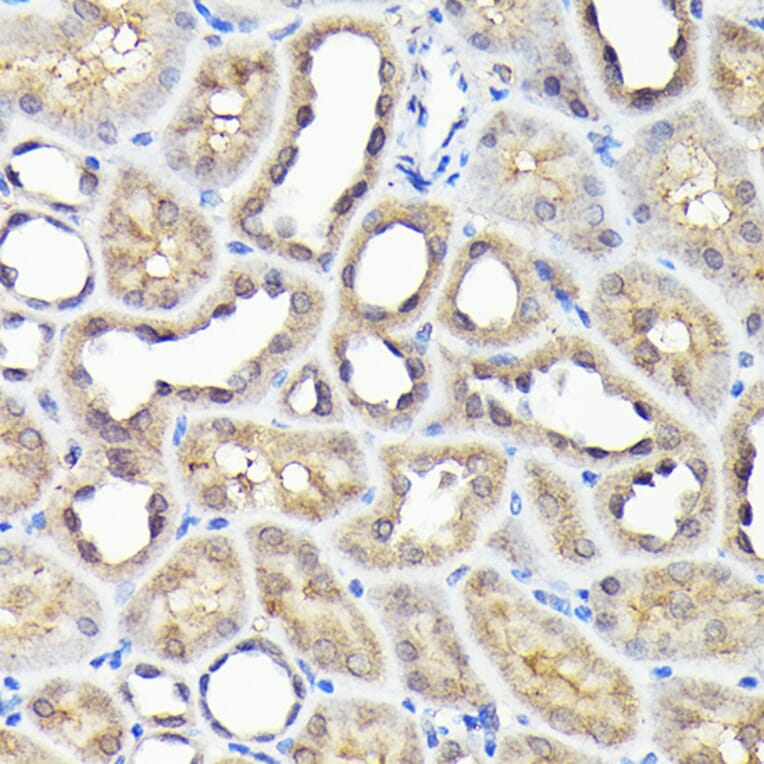 Immunohistochemistry - Anti-NADPH oxidase 4 Antibody (A13954) - Antibodies.com