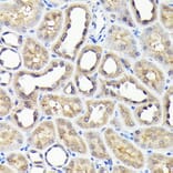 Immunohistochemistry - Anti-NADPH oxidase 4 Antibody (A13954) - Antibodies.com