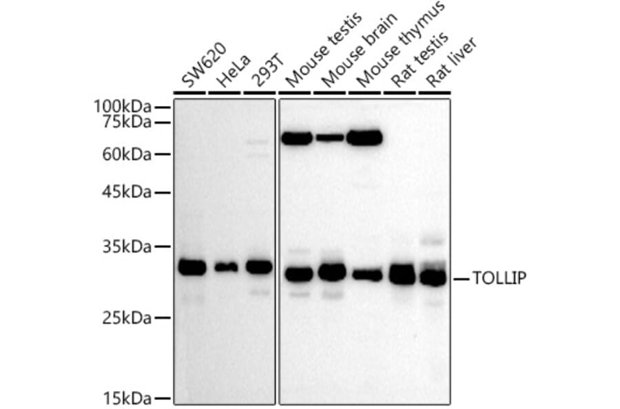 Western Blot - Anti-Tollip Antibody (A13955) - Antibodies.com