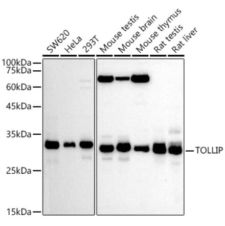 Western Blot - Anti-Tollip Antibody (A13955) - Antibodies.com