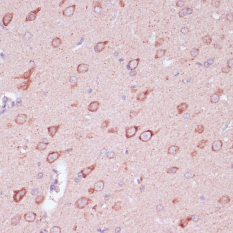 Immunohistochemistry - Anti-Tollip Antibody (A13955) - Antibodies.com