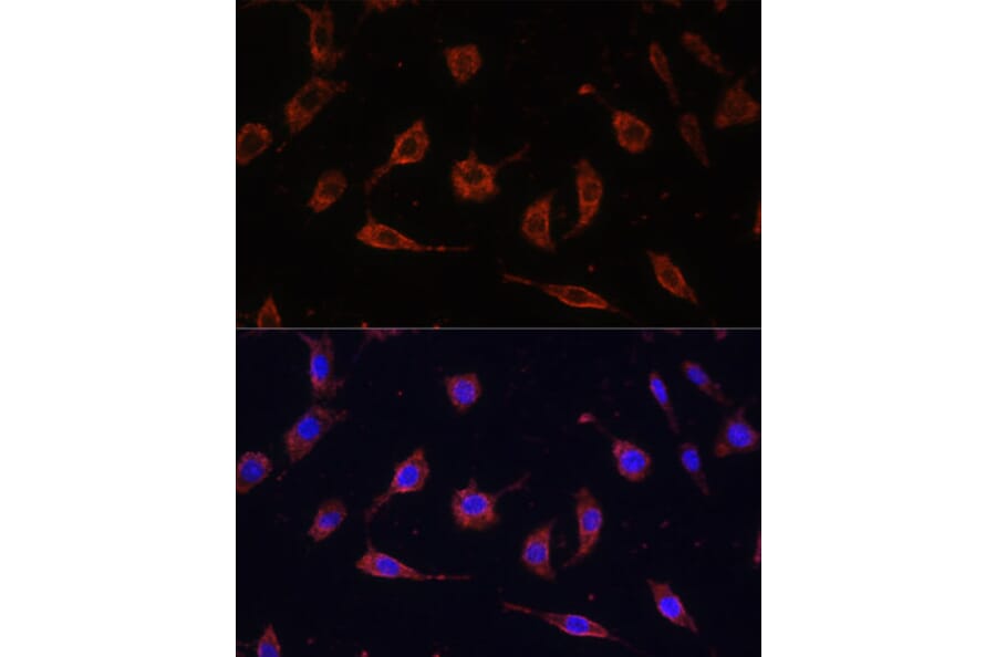 Immunofluorescence - Anti-Tollip Antibody (A13955) - Antibodies.com