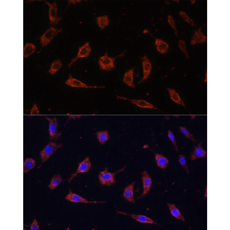 Immunofluorescence - Anti-Tollip Antibody (A13955) - Antibodies.com